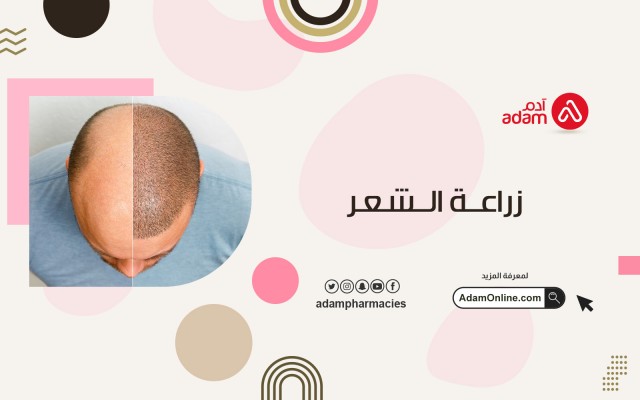 Hair transplantation 